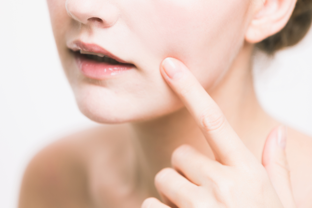 なかなか治らない顔の粉吹き原因と対策｜乾燥対策のメイク方法を解説